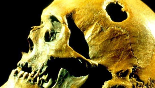 Древние люди почти не болели раком 