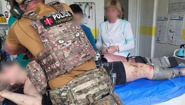 В Константиновке раненой девушке ампутировали ногу, ей требуется помощь