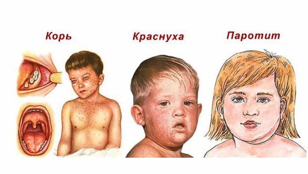 Вспышка кори в Украине: Минздрав запретил партию популярной вакцины