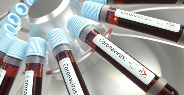 В Константиновской ОТГ восемь человек заразились коронавирусом