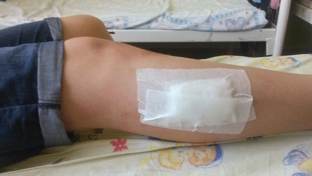 В Мирнограде трехлетний малыш ранил себя из пистолета