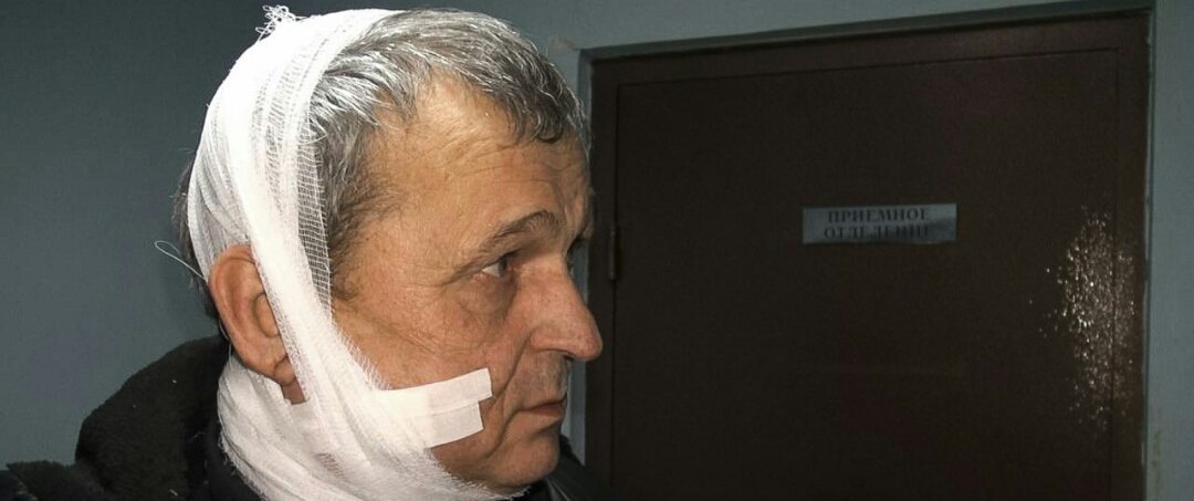 мужчина раненый возле Еленовки КПВВ