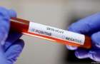 В США создали сверхбыстрый тест на коронавирус