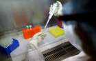 Минздрав опроверг свою информацию о восьми выздоровевших от коронавируса