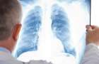 «Назревает эпидемия»: в Донецкой области увеличилось количество больных туберкулезом
