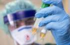 218 случаев коронавирусной инфекции лабораторно подтверждены в Украине
