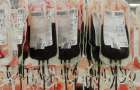 В Канаде создали универсальную донорскую кровь