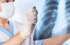 В Доброполье зарегистрирована вспышка вирусной пневмонии