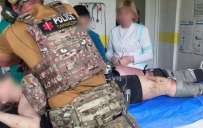 В Константиновке раненой девушке ампутировали ногу, ей требуется помощь