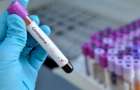 Украина получит экспресс-тесты для выявления коронавируса