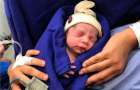 Женщина родила ребенка после пересадки матки от мертвого донора