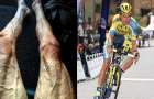 Фото ног велосипедиста испугало читателей соцсетей