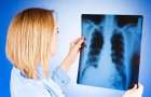В Мариуполе зарегистрировано более 500 больных с активной формой туберкулеза