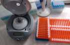 Больше тысячи новых случаев заболевания за два дня: Сводка по коронавирусу на Донетчине