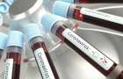Подозрение на коронавирус: В ДонОГА рассказали о состоянии госпитализированной