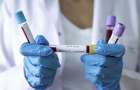 7 областей не подали данные тестирований на коронавирус — Минздрав