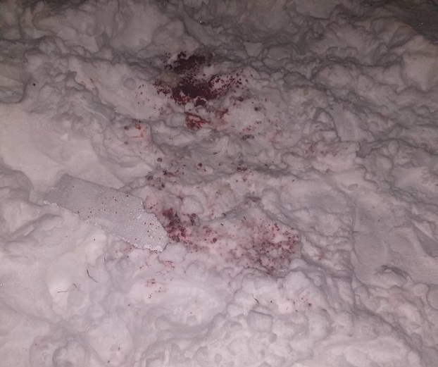 В Харькове мужчина потерял кисть, в результате запуска фейерверка