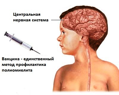 В Украине подписан приказ о вакцинации от полиомиелита