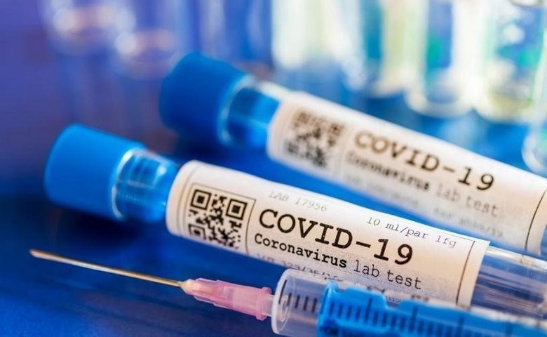 В Украине за сутки 656 новых случаев коронавируса