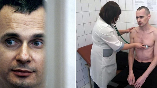 У Сенцова обнаружили многочисленные проблемы со здоровьем