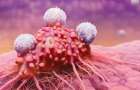 Найден способ остановки распространения четырех видов рака