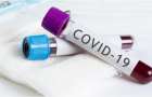 В Украине за сутки коронавирусом заразились 735 человек