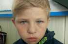 В курортной Кирилловке пропал 10-летний мальчик